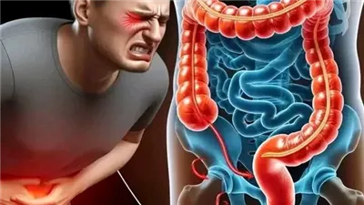 اعراض القولون العصبى علاج اعصاب المعدة والقولون العصبي في 3 ايام فقط