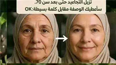 فوائد ورق الغار للشعر والبشرة والجسم ومرضي السكري