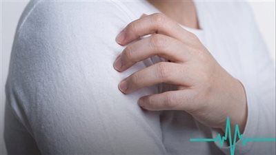 حكة الجلد.. أسباب شائعة من البشرة الجافة إلى الأمراض العصبية والنفسية