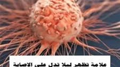 علامة تظهر ليلا تدل على الاصابة بالسرطان