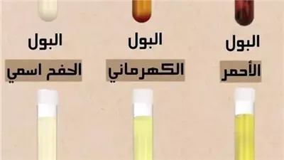 البـول الأحمر = جفاف حاد