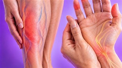 تظهر على اليدين والقدمين.. 6 أعراض أولية قد ترتبط بأمراض الكلى