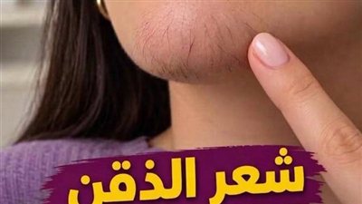 اذا كنتِ امرأة تعاني من شعر الذقن, انتبهي أليكِ ما يعتيه هذا