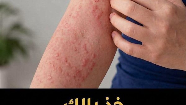 لمحة نيوز