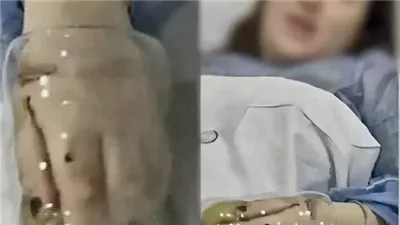 عملية بسبب كوباية